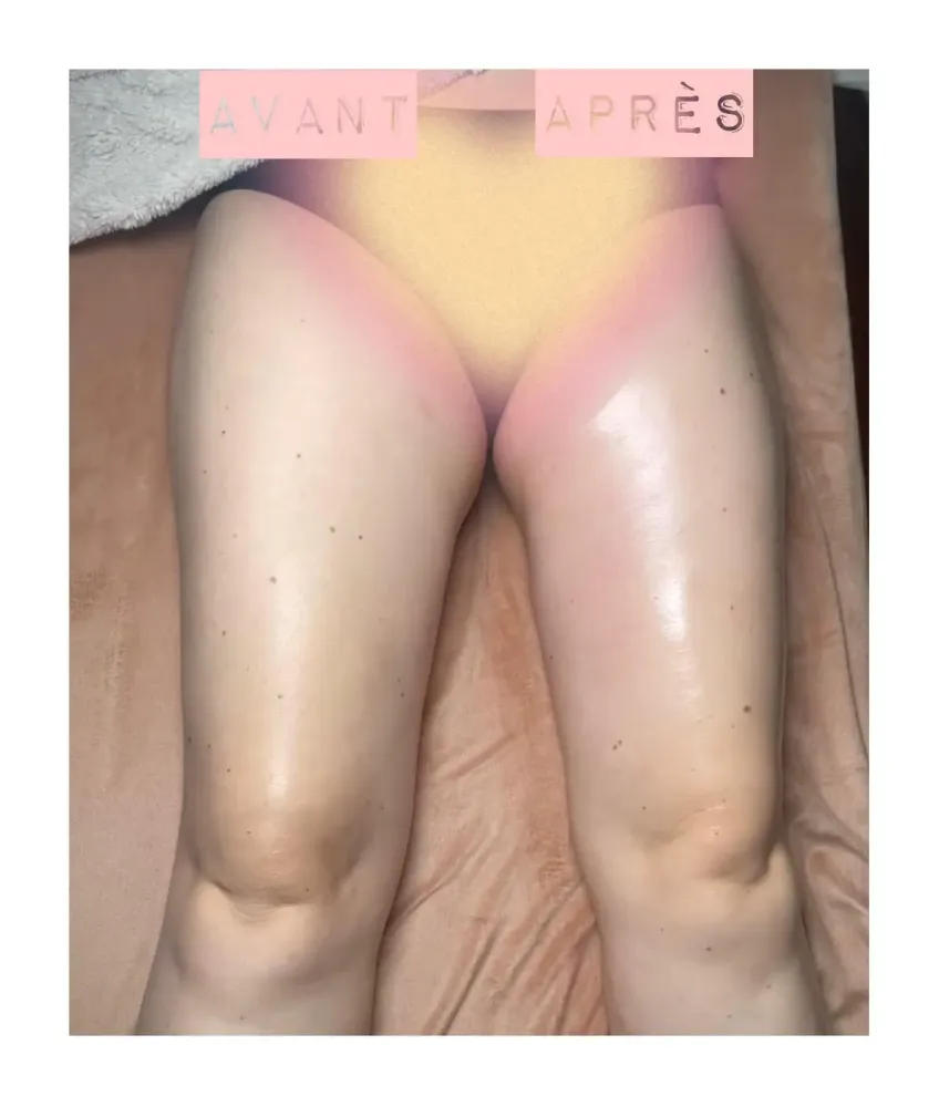 lymphomodelage-2