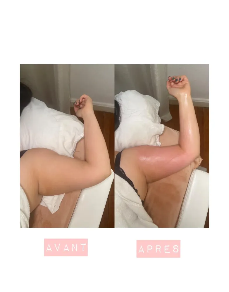 lymphomodelage-4